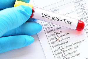 Uric Acid Test